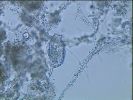 Nom del fitxer=rotifer 2.jpg
Mida del fitxer=97Kb
Dimensions=768x576
Data de publicació=20 de Octubre de 2005 rotifer 2.jpg